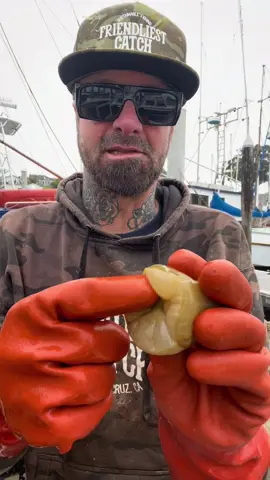 Sea Anemone experiment, Do crabs & Sea Anemones have symbiotic relationship? #fyp #anemone #seafood #fishing #bigfish #rockhold #ocean #seafoodlover #fish #natgeo #friendliestcatch 