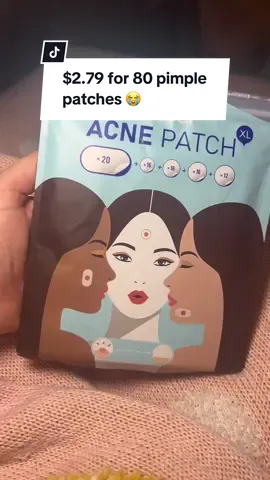 the pack comes with 80, making them $0.03 per patch 🫨🫨🫨 I’ve only seen this deal available in the TikTok Shop!  #pimplepatches #pimplepatch #skintok #skincaretiktok #products #pimplepatchcore #acneproneskin #skincaresale #affordableskincare #acneskin #acneskincare #tiktokshop #acneskincareproducts 