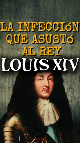 La curiosa historia de la infección que sufrió el Rey de Francia Luis XIV - #curiosidad #hechoscuriosos #curiosidades_varias 