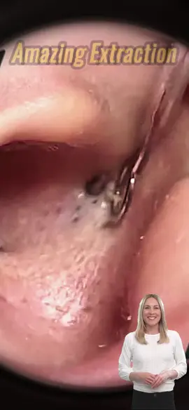 #viraltiktok #satysfying #relax #pimple #acne 