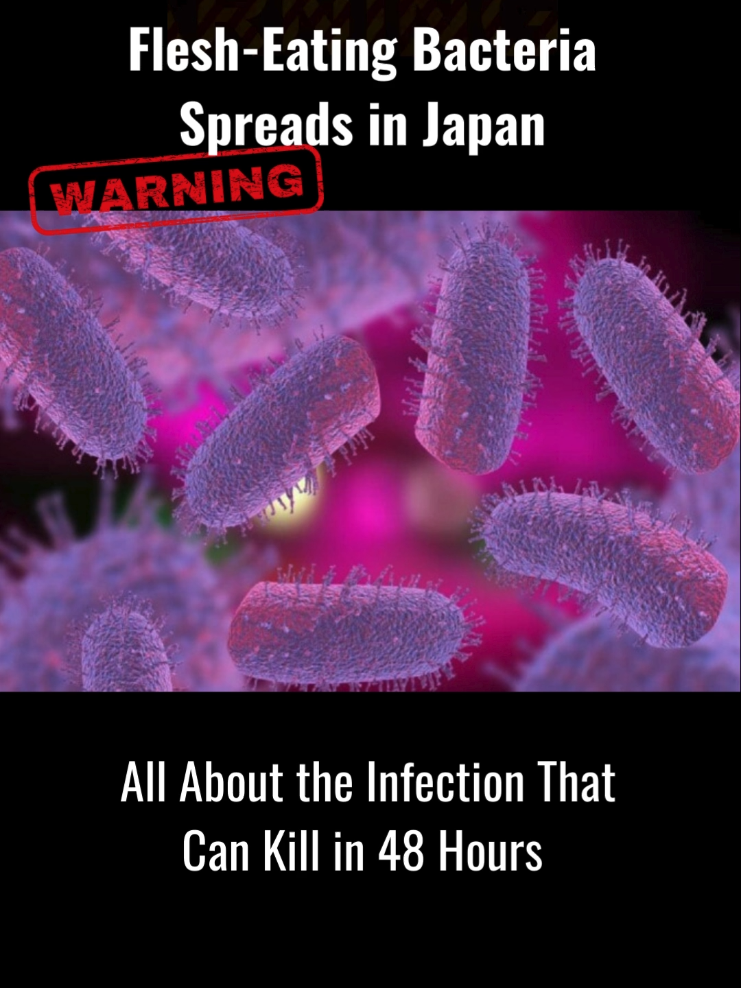 Flesh-Eating Bacteria:Infection That Can Kill in 48 Hours #FleshEatingBacteria #staysafe #STSS #healthawareness #warning⚠️ #fypage