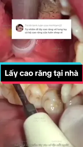 Các Bác Nào Đang  Gặp Tình Trạng Răng Đen, Sâu Răng, Răng Ố Vàng Do Cao Răng Lâu Ngày Tích Tụ. Dùng Ngay Gel Nano Bạc Gaolibai Đánh Bật Cao Răng, Sạch Mảng Bám Cho Hơi Thở Thơm Mát. #gaolibai #gaolibaigeldanhbaycaorang #geldanhrang #kemdanhrang #caorang #hoimieng #viemloi #saurang #sauranghoimieng #răng #lamdep 