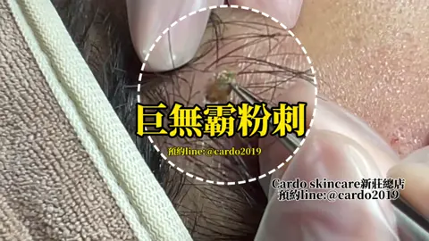 ⚠️預約line：@cardo2019⚠️ #現在課程有買一送一優惠 Cardo skin care 預約服務分店 新莊總店｜新店店｜圓山店｜蘆洲店 中和店｜林口店｜中壢店｜汐止店｜景美店 #美容保養 #美容 #保養 #粉刺 #痘痘 #做臉 #台北 #cardo #林口 #三重清粉刺 #泰山做臉 #龜山做臉 #新莊做臉 #新莊清粉刺 #林口清粉刺 #迴龍清粉刺 #樹林清粉刺 #蘆洲清粉刺 #黑眼圈 #丹鳳做臉 #男生做臉 #男生清粉刺 #男生保養 #新莊護膚 #台北護膚 #婚前保養 #耳燭 #美容教學 