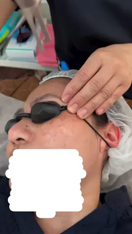 📍NAGOYASHI NAKAKU SAKAE 3-33-30 T.O BUILDING 4th floor #PICOTONING #FIRSTSESSION #viviagebeautyclinicnagoyasakae