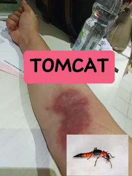 Selamat bermalam minggu, buat yg jomblo hati2 ditempelin Tomcat ya..#fypシ゚viral #tomcat #racuntomcat #edukasi #edukasikesehatan #promkes #puskesmas #dokter 