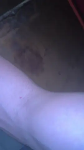 بلشغل وضوجه☠️💔