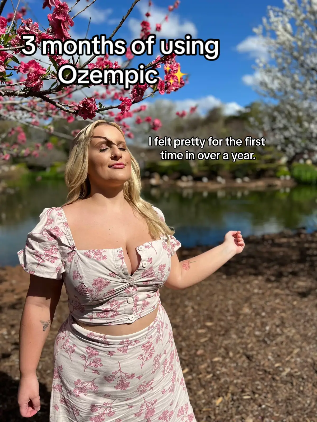 Before you have a go at me or judge me, Ozempic was what my Dr recommended and i was using it prior to the shortages. It was either lose weight or unalive myself. I was tired of being trapped in a body that didnt feel like me.  The stretch marks on my stomach from weight gain were a constant reminder of how the brain tumour ruined my life, made me spiral into a depression and then resulted in daily suffering with migraines as a result of the meningioma resection.  #fyp #ozempicjourney #foryou #weightloss #transformation #blonde #reddit #capcut #journey #instagram #weightlosstransformation 