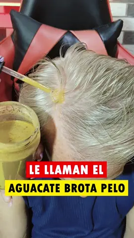 El aceite que hace salir pelo en una semana y detiene su caída #caidadecabello #hair #cabellolargo 