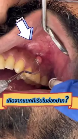 ยาสีฟันแบบพกพาและใช้งานง่าย คุณสมควรได้รับมัน #พกง่ายสบายเป๋า #Dentamate #โล่งลึกหอมล้น #เดนตาเมท #ยาสีฟัน