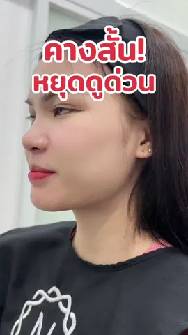 หยุด!! หยุดดูเดี๋ยวนี้เลยนะจ๊ะ คางสั้นคางตัด💢 #nachatclinic #ณฉัตรคลินิก #เปิดการมองเห็น #ฟิลเลอร์ 