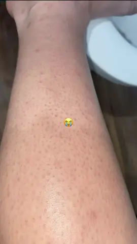 My skin improved so much with this 🥹 #fyppppppppppppppppppppppp #fypシ゚viral #showerroutine #skincareroutine 