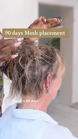 Story time  mesh integration hair extensions . 90 days retouch  #stylebyevehair #hairextensions #stylebyeve #hairtransformation #meshintegration #hairremoval  #meshintegrationtraining 