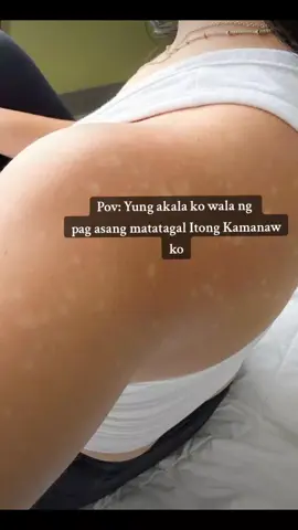 Grabe ba!! Let say Good Bye An-an to Hello Kinis  #naturemiraclekasoycream #kasoycreambyilovenatureorganic #fyp #an-an #pantanggalnganan #fyp #foryou #kamanaw #pantanggalngkamanaw 