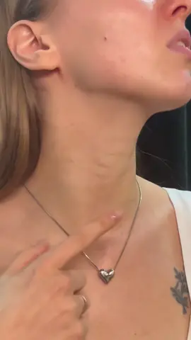 Get a youthful neck in just minutes a day!#ycz #yczneckcream #fyp #foryou #viral #yczskincare #tiktokfinds#tiktokmademebuyit #skincare #skin #luxuryskincare #TikTokBeauty 