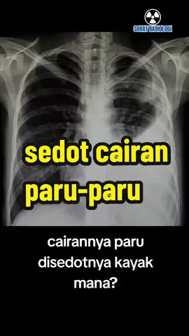 #ctscan #radiologi #radiology #ge #scan #xray #mri #scanning #fyp #fypシ #fypシ゚viral #fypage #rontgen #ronsen #radiologist #radiologylife #radiologytechnologist #radiologytiktok #radiolog #MRI #RADIOLOGI #RONTGEN #CTSCAN #RADIASI #XRAY #TULANG #TUMOR #KANKER #PEMERIKSAAN #RADIOLOGIPEDIA #penyakit 
