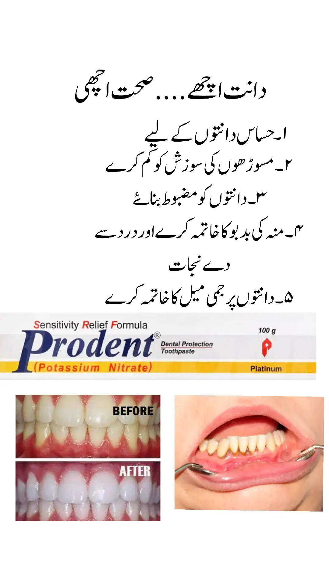 Prodent toothpaste #foryou #Health #Healthiswealth #Daily #viral 