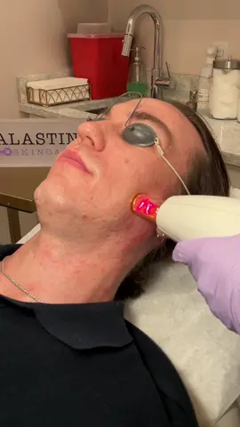 ✨Discover the rejuvenating benefits of ResurFX Laser, a state-of-the-art non-ablative treatment renowned for stimulating collagen production and effectively reducing fine lines, wrinkles, and acne scars. 😍This innovative procedure promotes skin renewal and texture improvement without downtime, making it ideal for achieving smoother, more youthful-looking skin.🙌 Pairing ResurFX with Alastin Skin Nectar enhances your post-treatment care regimen.🧴This advanced formula accelerates skin recovery, diminishes redness and inflammation, and supports the production of collagen and elastin. Together, they ensure a revitalized complexion that is radiant and refreshed.🫶 Call to book your appointment 516.868.3450 📞✨ - -  #boostyourbeautymedispa   #ResurFX #AlastinSkinNectar #SkinRejuvenation #PostTreatmentCare #cannulaqueen #medispa #wrinkles #dysport #skin  #lipfiller #medspa #skincare #botox #beauty #antiaging #aesthetics #fillers #medicalspa #skin #antiwrinkle  #injectables #lipfiller #esthetician #facials #dermalfillers #boostbabe  #botox #LaserFacials #SkinRevival #YouthfulGlow #AntiAging #HealthySkin #LaserTreatments #SkinCare #AlastinSkinNectar #HealthySkin #BeautyRoutine