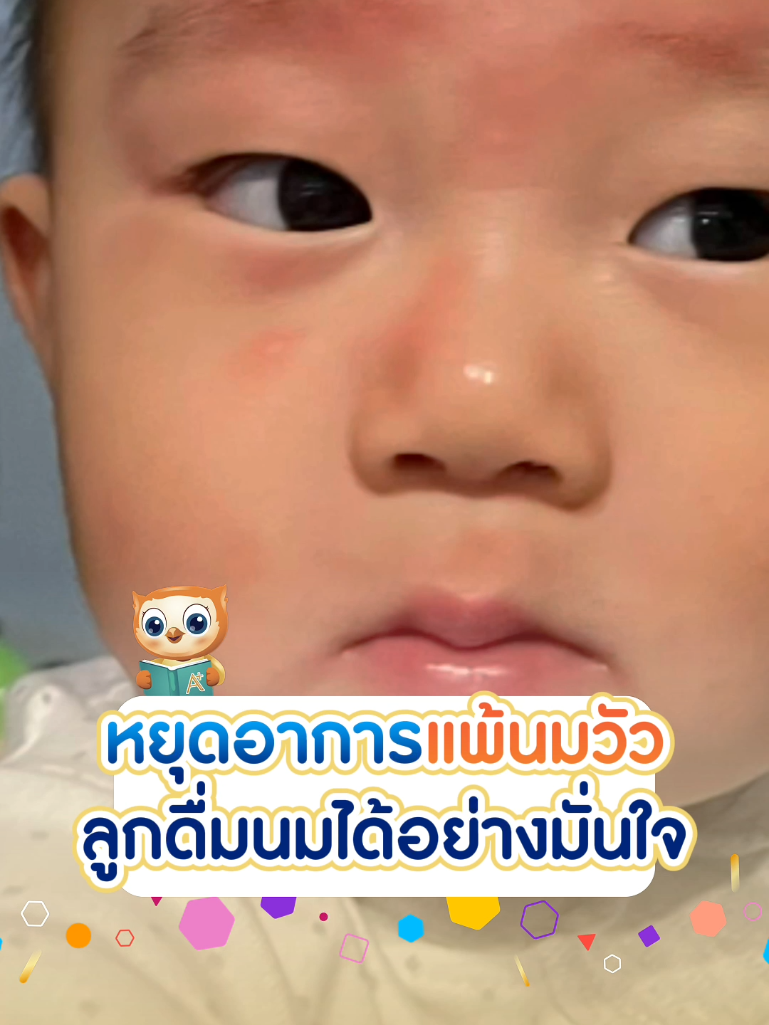 ถ้าลูกคัน ผื่นขึ้น น้ำมูกไหล อาจแพ้นมวัว! วันนี้แม่มาแชร์วิธีดูแลลูกน้อยที่แพ้นมวัวกันค่ะ เพราะลูกแพ้นมวัว คุณแม่ดูแลได้ ตั้งแต่วันนี้🧡  #EnfaSmartClub #แพ้นมวัว #เริ่มต้นดีไม่มีแพ้  #BabyAllergyExpert​ #WorldAllergyWeek2024