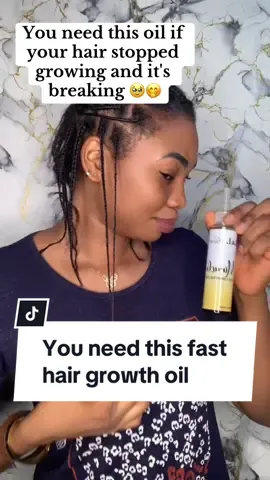 You need this oil ✅ Price:  Miracle Hair growth oil : N8,000 Hair Meal : N9,000 To order for yours send us a message on whattsapp; 09169500604 hair growth oil in nigeria fastest hair growth oil 7 days hair growth how to grow hair in 3 days using natural. hair oil for growth and thickening hair growth oil for long hair in nigeria homemade oil for hair growth in nigeria hair growth in 7 days shampoo hair growth oil in nigeria fastest hair growth oil 7 Days Hair Growth wild growth hair oil results in 1 week hair growth oil watson kemunto hair growth oil zees hair growth oil hair growth oil 4c nigerian product for hair growth hair growth product in nigeria hair regrowth treatment 7 days hair growth hair growth set product hair growth in 3 months 30 day hair growth challenge homemade hair growth product  #hairgrowthproduct #hairgrowthoil #organichairgrowthoil #hairgrowthoilsworks #hairgrowthoilforfastgrowth #hairmaskforhairgrowthcurly #hair_growth_oil #skincareforglowingskinproducts #naturalhairgrowthremedy #hairgrowthproducts #hairgrowthproductsforlonghair #besthairgrowthproduct#SmallBusiness  