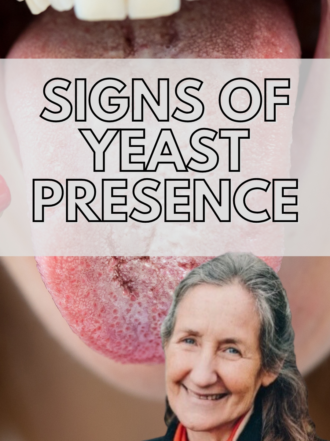 Signs of yeast presence #barbaraoneill #eczema #psiorasis #yeastinfection