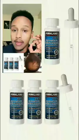 minoxidil waa xalka bidaarta iyo daadashada timaha. #minoxidil #hairgrowthoil #supplements #tiktoksomalia🇸🇴 #fyppppppppppppppppppppppp 