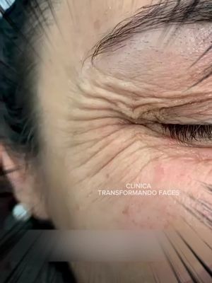 Preferred anti-wrinkle cream, rich in peptides