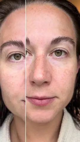 3% hylauronic acid with 4 molecule sizes actually rejuvenates and remoisturizes your skin at a deeper level because the small molecules can get in there vs most HA serums on the market that sit on top of your skin! @WNP SKINCARE #hylauronicacid #skincare #agingskin #aginggracefully #naturalbeauty #skincaretips #skincaretiktok #dealsfordays 