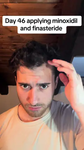 #hairtransplant #hairstyle #hair #asmr #finasteride #minoxidil #hairroutine #haircare #beauty #alopecia  