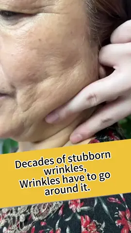 Anti-wrinkle cream to lift and tighten #wrinkle #wrinkles #wrinkletreatment #skincare #skincaretips