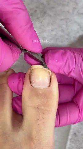 ASMR DE UMA UNHA RECHEADA 🤤 #unha #nails #asmr #fyp #satisfying #transformation #viral 