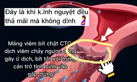 Kinh nguyệt đều mà thả mãi không bầu. Mom nào đang gặp tình trạng giống vậy ạ?🤰🤰#xuhuong #kinhnguyet #hongmattay #chuachamconhiemmuon #mongcon 