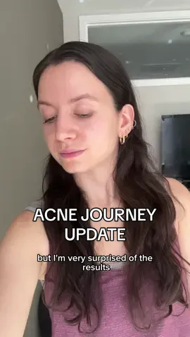 My acne journey as a 26 year old and a update on using Tretinoin #acne #acnecheck #acnejourney #acneskin #acneproneskin 