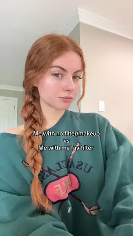 Well i guess i need lip filler or smthin