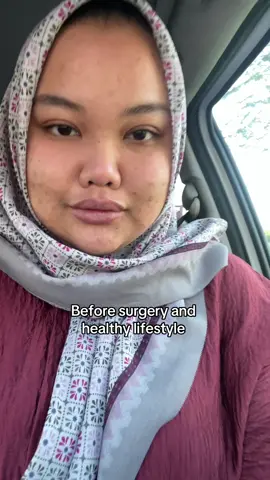 Ayuh waniterr this is reward yang sebenar untuk diri sendiri #fypシ゚viral #bariatricsurgery #fyp #Fitness #healthy 