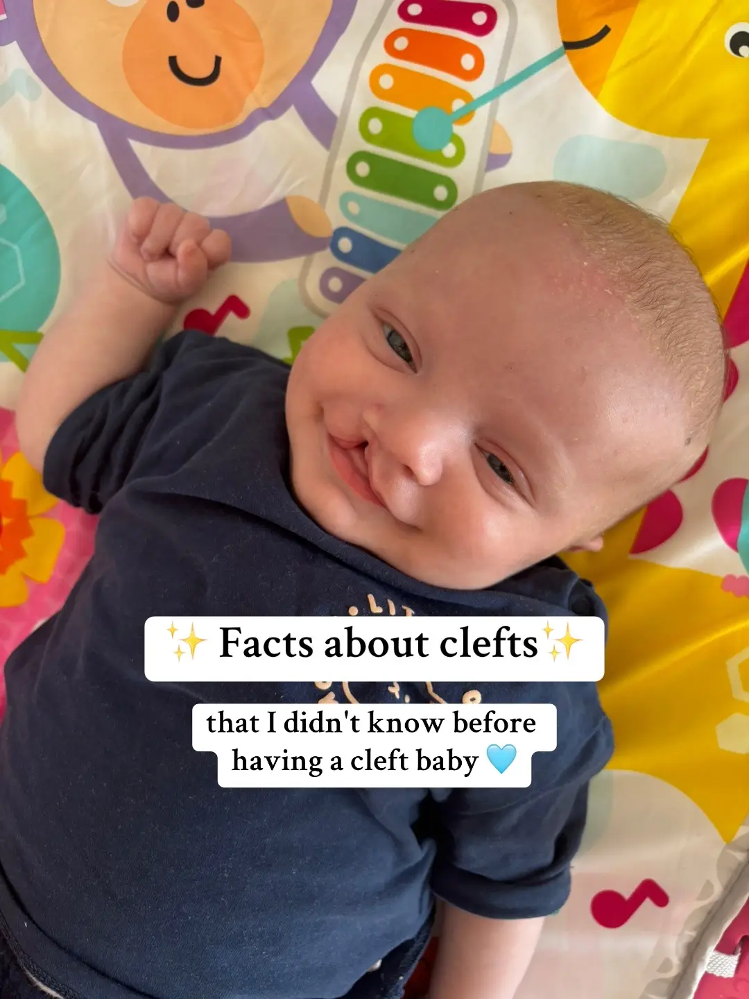 #cleftawareness #cleftstrong #cleftlip #cleft #cleftpalate #spreadingawareness 