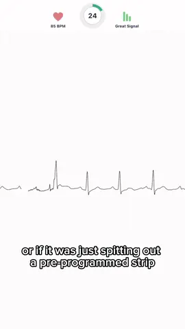 Testing out an at home ekg device. Is the juice worth the squeeze? Maybe for some, it might give you peace of kind as you can have your ekg read by cardiologists remotely. But at the end of the day, its sort of gimicky and a pulse ox can give you the same information. #ems #medic #er #rn 