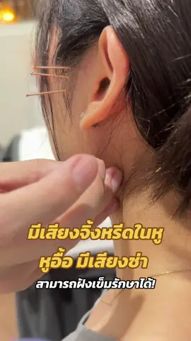มีเสียงจิ้งหรีดดังในหูอยู่ตลอดเวลา หรือมีเสียงซ่า หูอื้อตลอด แนะนำการฝังเข็มเลยค่ะ ได้ผลดี แต่แนะนำทำต่อเนื่อง 3-5 ครั้งขึ้นไปนะคะ #ฝังเข็ม #ฝังเข็มรักษาโรค #หูอื้อ #เสียงในหู #เสียงจิ้งหรีดในหู #แพทย์จีน #หมอจีน #acupuncture #ฟาจินคลินิก 