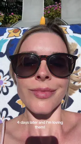 My first time getting lip filler & i love them!😍 i got 1 syringe of restylnne kysse!  #lipfiller #restylanekysse #transformation #liptransformation 