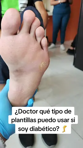 Doctor qué tipo de plantillas puedo usar si soy diabético? 🦵🧠👋 #parati #videoparati #viral #streamer #doctoroftiktok #docArtemio #doctordetiktok #doctorenXalapa #doctoroftiktok #expertoendolor #expertoenneuropatias #diabetes #dm2 #azucar #neuropatia #neuropatiadiabetica #dolores #ardores #calambres #entumecimiento #piquetes #debilidad #debilidaddepiernas #deshuanso #vitaminas #tratamiento #diagnostico #hablandodesalud #hablandodeneuropatia #doctordetiktok #doctoroftiktok #fyp #foryourpage #fypviral #fypage 