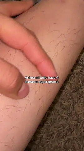 Comprala te encantarán los resultados 🥰🥰🥰 @Ulike Beauty #ulikehairremoval #ulikeair+ #laserhairremoval #IPLhairremoval #Ulike 