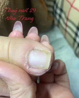 #thuynail89 #chuyêncắtdaẩn #lấykhóe 