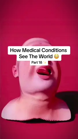 How Medical Conditions See The World 😳 #interesting #viral #trending #scary #fypシ 
