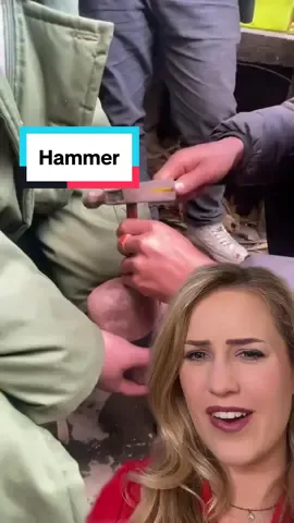 How to scare a doctor 😳 🎥 isaacmarionqj1 #injury #plottwist #scary #reaction #doctorreacts 
