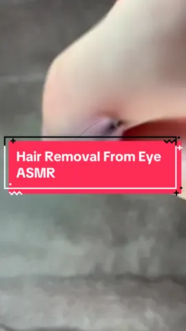 Removing Hair Form Eye Roleplay #asmr #relax #asmrsounds 