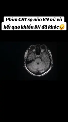 Phim chụp CHT của  1bệnh nhân nữ và kết quả buồn BN đã khóc 😭😭 #ct #mri #suckhoe #suckhoelavang 