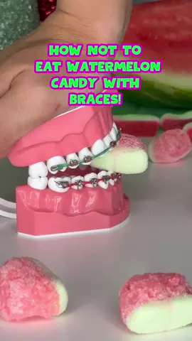 What's your favorite watermelon candy? 👀 #braces #watermelon #candy #jollyrancher #foryou 