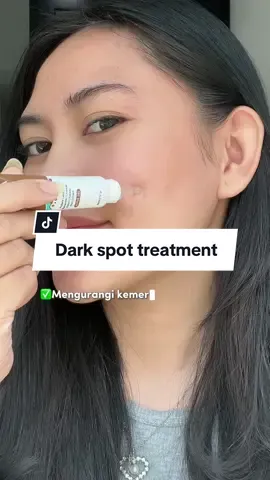 Solusi untuk menghilangkan bekas jerawat yang hitam, yuk checkout🥰 #imploracosmetics #ApprovedbyMe #wajibpunyaimplora #imploradarkspottreatment 