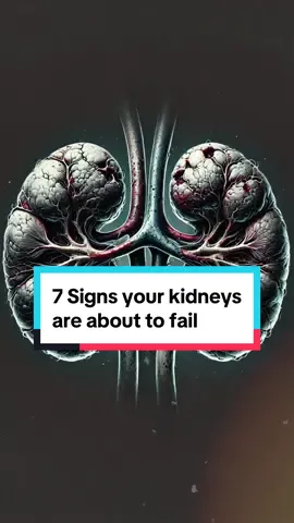 Silent Signs Your Kidneys Are About to Fail #health #kidneyfailure #healthtips 