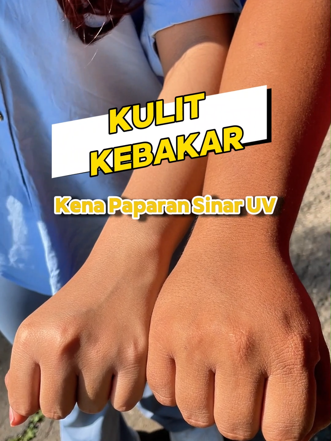 Gaya dan perlindungan dalam satu paket! Jaket anti UV untukmu yang peduli akan kesehatan kulit. Diskon 50% untuk yang join live! Join sekarang juga! #jaketantiuv #kktop #jaketuv