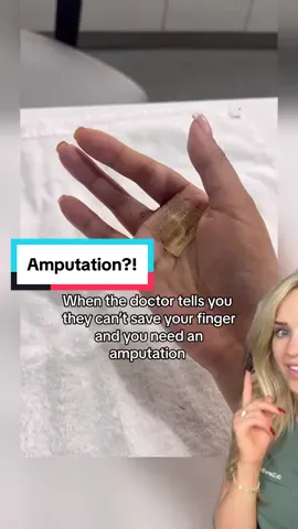 This is why the finger was amputated! 😳  🎥 @Natalie Garcia  #giantcelltumor #doctor #doctorreacts #doctorsoftiktok #learnsomethingnew #medical #surgery #medicalvideos #doctors #podiatry #podiatrist #footsurgeon #surgeon #surgeons #nurse #nurses #healthcare #scrublife #medicalhumor #scrubslife #podiatric #medicine 